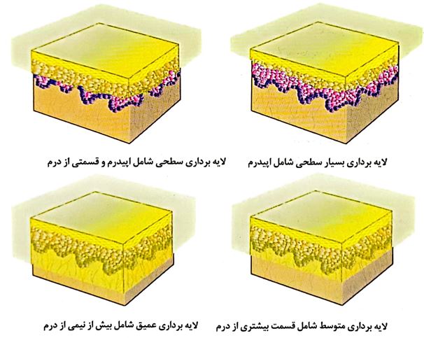 لابه برداری شیمیایی